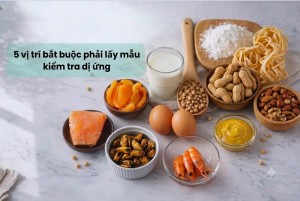 5 vị trí bắt buộc phải lấy mẫu kiểm tra dị ứng...